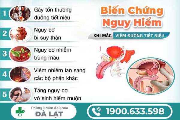 Hình ảnh minh họa